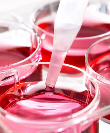 Core Web Vitals in 2026: Why Poor Scores Are Silent Revenue Killers for eCommerce